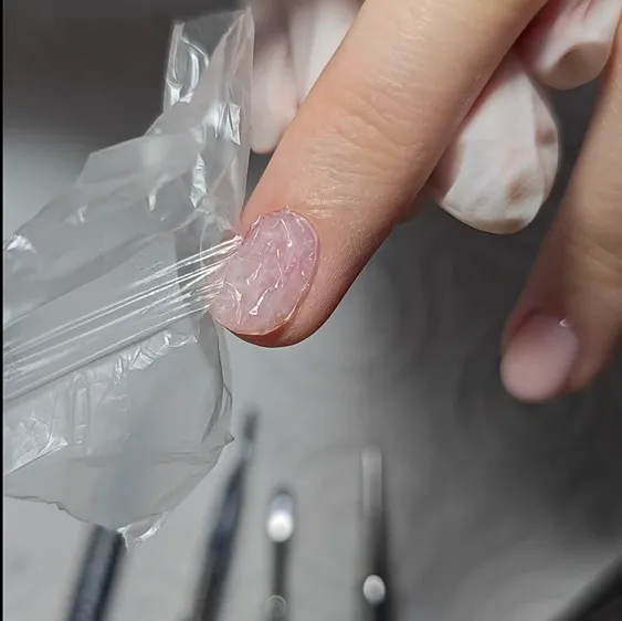 Fólia eltávolítása köttetés után