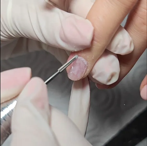 Sáncok tisztítása karbid lándzsafejjel